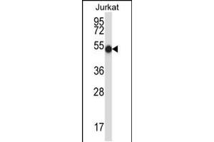 Western blot analysis in Jurkat cell line lysates (35ug/lane). (PNKP antibody  (N-Term))