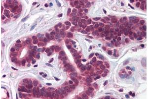 Human Breast: Formalin-Fixed, Paraffin-Embedded (FFPE) (T-Box 18 antibody  (AA 511-560))