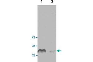 Western blot analysis of human fetal liver (Lane 1) and HepG2 cell (Lane 2) lysate with CLIC2 polyclonal antibody  at 1 : 250 dilution. (CLIC2 antibody  (Internal Region))