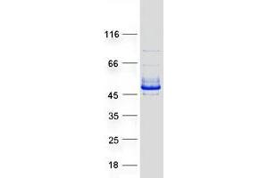 Ring Finger Protein 113B (RNF113B) protein (Myc-DYKDDDDK Tag)
