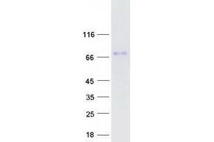 Validation with Western Blot (TAGAP Protein (Transcript Variant 1) (Myc-DYKDDDDK Tag))