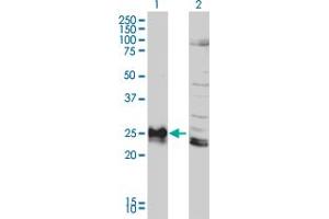 Western Blotting (WB) image for anti-Major Histocompatibility Complex, Class II, DP beta 1 (HLA-DPB1) (AA 1-258) antibody (ABIN561271)
