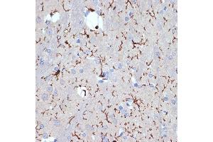 Immunohistochemistry of paraffin-embedded rat brain using //IB Rabbit mAb (9776) at dilution of 1:100 (40x lens). (Iba1 antibody)