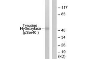 Western blot analysis of extracts from RAW264. (Tyrosine Hydroxylase antibody  (pSer71))