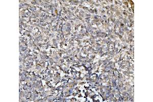 IHC analysis of EXOSC8 using anti-EXOSC8 antibody (ABIN7601850). (EXOSC8 antibody  (AA 49-216))