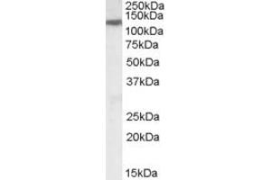 ABIN238578 (0. (SLC12A6 antibody  (Internal Region))