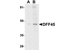 Western blot analysis of DFF45 in HeLa cell lysate with AP30290PU-N DFF45 antibody at (A) 1 and (B) 2 μg/ml.