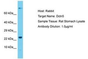 Image no. 1 for anti-Dynactin 5 (p25) (DCTN5) (N-Term) antibody (ABIN6750438) (DCTN5 antibody  (N-Term))