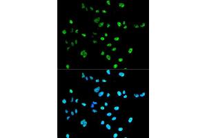 Immunofluorescence analysis of A549 cell using PAX2 antibody.