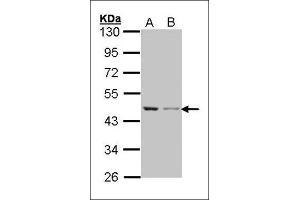 Western blot: Sample (30 µg of whole cell lysate). (beta Actin antibody)