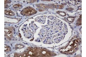 Immunohistochemistry (IHC) image for anti-Crystallin, alpha A (CRYAA) antibody (ABIN1498754) (CRYAA antibody)