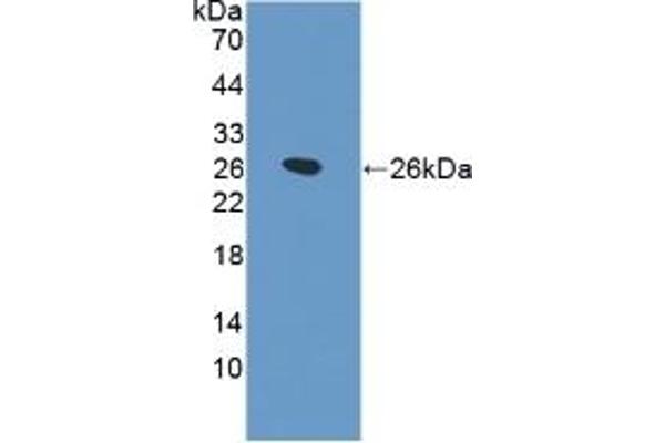 SFTPB antibody  (AA 111-352)