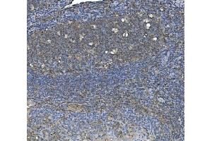 IHC analysis of eRF1/ETF1 using anti-eRF1/ETF1 antibody (ABIN7602626). (ETF1 antibody  (AA 9-342))