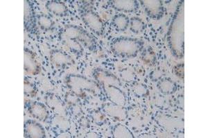 Immunohistochemistry (IHC) image for anti-Interleukin-27 subunit beta (IL-27b) (AA 21-229) antibody (ABIN7426622)