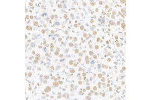 Immunohistochemistry (IHC) image for anti-Mediator Complex Subunit 1 (MED1) (AA 1550-1581) antibody (ABIN7455140) (Recombinant MED1 antibody  (AA 1550-1581))