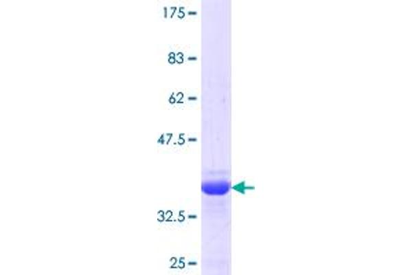 SLC20A2 Protein (AA 243-342) (GST tag)