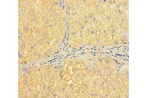 Immunohistochemistry of paraffin-embedded human liver tissue using ABIN7155373 at dilution of 1:100 (H2AFB1 antibody  (AA 1-115))