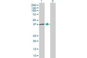 Western Blot analysis of LPGAT1 expression in transfected 293T cell line by LPGAT1 MaxPab polyclonal antibody. (LPGAT1 antibody  (AA 1-370))