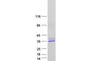 Western Blotting (WB) image for DnaJ (Hsp40) Homolog, Subfamily C, Member 5 (DNAJC5) protein (Myc-DYKDDDDK Tag) (ABIN2719605)