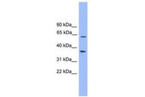 Image no. 1 for anti-Pyruvate Dehyrogenase Phosphatase Catalytic Subunit 2 (PDP2) (AA 359-408) antibody (ABIN6745150) (PDP2 antibody  (AA 359-408))