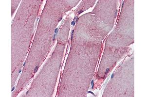 Anti-GSTM2 antibody IHC of human skeletal muscle. (GSTM2 antibody  (AA 90-190))