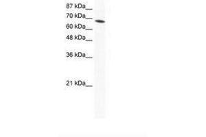 Image no. 1 for anti-DEAD (Asp-Glu-Ala-Asp) Box Polypeptide 1 (DDX1) (AA 671-720) antibody (ABIN202891) (DDX1 antibody  (AA 671-720))