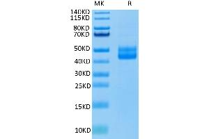 Human CD3E/CD3 epsilon monomer on Tris-Bis PAGE under reduced condition. (CD3 epsilon Protein (CD3E) (AA 23-126) (Fc Tag))