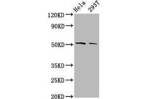 Western Blot Positive WB detected in: Hela whole cell lysate, 293T whole cell lysate All lanes: PLAGL2 antibody at 3. (PLAGL2 antibody  (AA 324-469))