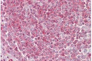 Anti-RIPK3 / RIP3 antibody IHC staining of human spleen. (RIPK3 antibody  (AA 251-300))
