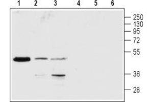 Western Blotting (WB) image for anti-Purinergic Receptor P2Y, G-Protein Coupled, 1 (P2RY1) (AA 207-220), (Extracellular) antibody (ABIN7043584)