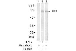 Image no. 2 for anti-Heat Shock Factor Protein 1 (HSF1) (Ser307) antibody (ABIN197434) (HSF1 antibody  (Ser307))