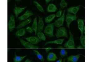 Immunofluorescence analysis of L929 cells using RAPGEF1 Polyclonal Antibody at dilution of 1:100 (40x lens). (GRF2 antibody)