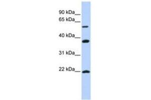 Image no. 1 for anti-Myosin Regulatory Light Chain Interacting Protein (MYLIP) (AA 360-409) antibody (ABIN6743161) (MYLIP antibody  (AA 360-409))