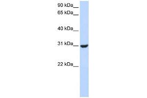 WB Suggested Anti-RNF182 Antibody Titration:  0. (RNF182 antibody  (Middle Region))