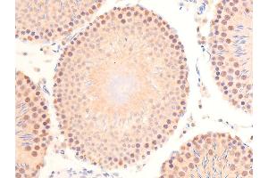 Immunohistochemistry (IHC) image for anti-Tumor Protein P53 (TP53) (pSer392) antibody (ABIN6256312)