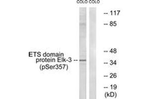 Western blot analysis of extracts from COLO205 cells treated with serum 20% 15', using Elk3 (Phospho-Ser357) Antibody. (ELK3 antibody  (pSer357))