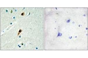 Immunohistochemistry analysis of paraffin-embedded human brain tissue, using RBM5 Antibody. (RBM5 antibody  (AA 226-275))