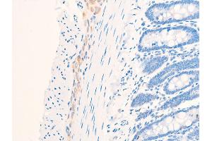 Immunohistochemistry (IHC) image for anti-Epidermal Growth Factor Receptor (EGFR) (pSer1026) antibody (ABIN6254923)