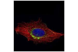 ICC/IF Image Confocal immunofluorescence analysis (Olympus FV10i) of methanol-fixed HeLa, using RAB6A, antibody (Green) at 1:1000 dilution. (RAB6A antibody)