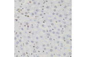 Immunohistochemistry of paraffin-embedded rat liver using AKAP8 antibody.