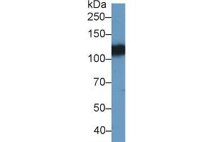 Detection of EPHA4 in Porcine Cerebrum lysate using Polyclonal Antibody to Ephrin Type A Receptor 4 (EPHA4) (EPH Receptor A4 antibody  (AA 621-882))