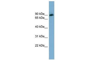 APBB1IP antibody used at 1 ug/ml to detect target protein. (Amyloid beta (A4) Precursor Protein-Binding, Family B, Member 1 Interacting Protein (APBB1IP) (N-Term) antibody)