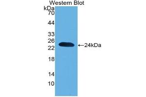Detection of Recombinant PARK7, Mouse using Polyclonal Antibody to Parkinson Disease Protein 7 (PARK7) (PARK7/DJ1 antibody  (AA 1-189))