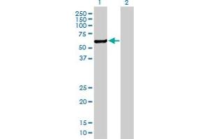 Western Blot analysis of CHKA expression in transfected 293T cell line by CHKA MaxPab polyclonal antibody. (Choline Kinase alpha antibody  (AA 1-457))
