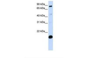 Image no. 1 for anti-SP110 Nuclear Body Protein (SP110) (C-Term) antibody (ABIN6739452) (SP110 antibody  (C-Term))