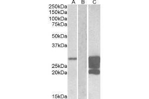 HEK293 lysate (10ug protein in RIPA buffer) overexpressing Human GM2A with DYKDDDDK tag probed with ABIN2562857 (1. (GM2A antibody  (AA 179-189))