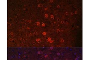 Immunofluorescence analysis of Mouse brain using TRPM2 Polyclonal Antibody at dilution of 1:100. (TRPM2 antibody)