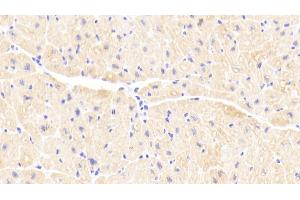 Detection of TNNC1 in Human Cardiac Muscle Tissue using Polyclonal Antibody to Troponin C Type 1, Slow (TNNC1) (TNNC1 antibody  (AA 1-161))