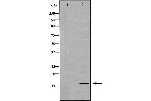 Western blot analysis of extracts of SW480 , using MDK antibody.