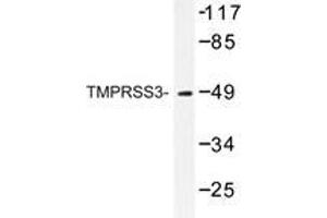 Western blot analysis of TMPRSS3 antibody in extracts from HUVEC cells. (TMPRSS3 antibody)